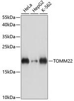 TOMM22 Polyclonal Antibody