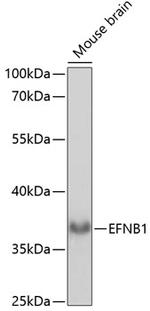Ephrin B1 Polyclonal Antibody