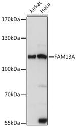 FAM13A Polyclonal Antibody