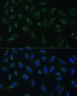 HIGD1A Polyclonal Antibody