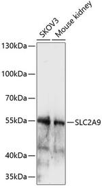 GLUT9 Polyclonal Antibody