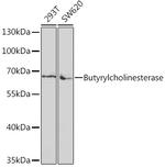 Butyrylcholinesterase Polyclonal Antibody