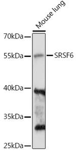 SRSF6 Antibody in Western Blot (WB)