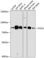 Factor XIII A Polyclonal Antibody