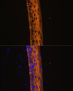 MYH13 Antibody in Immunohistochemistry (Paraffin) (IHC (P))