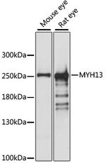MYH13 Antibody in Western Blot (WB)