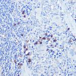 TLR9 Antibody in Immunohistochemistry (Paraffin) (IHC (P))