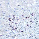 TLR9 Antibody in Immunohistochemistry (Paraffin) (IHC (P))
