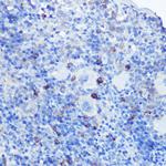 TLR9 Polyclonal Antibody