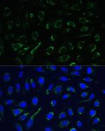 IDH3A Polyclonal Antibody