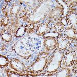 IDH3A Antibody in Immunohistochemistry (Paraffin) (IHC (P))