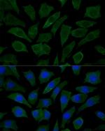 COX15 Polyclonal Antibody