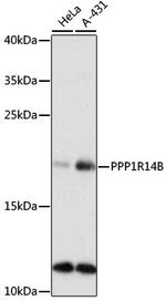 PP14B Polyclonal Antibody