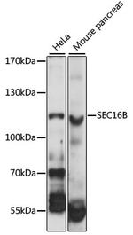 LZTR2 Polyclonal Antibody