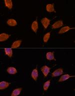Importin 8 Polyclonal Antibody