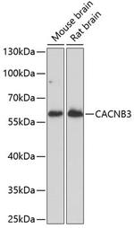CACNB3 Polyclonal Antibody