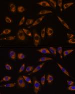 GNAQ Polyclonal Antibody