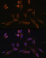 NDUFA5 Polyclonal Antibody