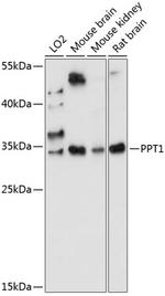 PPT1 Polyclonal Antibody