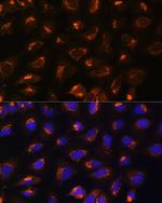 MEK2 Antibody in Immunocytochemistry (ICC/IF)