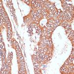 PTPRN2 Polyclonal Antibody