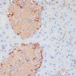 PTPRN2 Antibody in Immunohistochemistry (Paraffin) (IHC (P))
