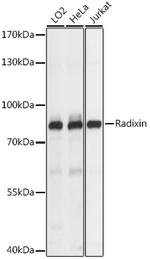 Radixin Polyclonal Antibody