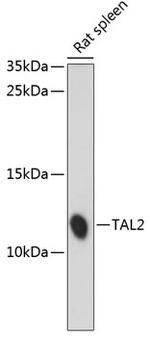 TAL2 Polyclonal Antibody