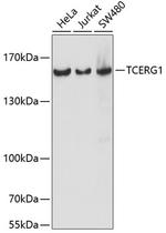 CA150 Polyclonal Antibody