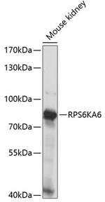RSK4 Polyclonal Antibody