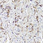 TLR8 Polyclonal Antibody