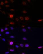 KLHL8 Antibody in Immunocytochemistry (ICC/IF)