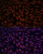 KLHL8 Antibody in Immunocytochemistry (ICC/IF)