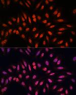 KLHL8 Polyclonal Antibody