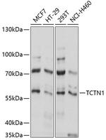 TCTN1 Antibody in Western Blot (WB)
