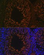 LDHAL6B Polyclonal Antibody