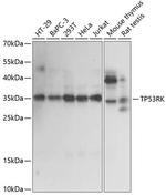 PRPK Polyclonal Antibody