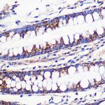 MRPL54 Polyclonal Antibody