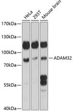 ADAM32 Polyclonal Antibody