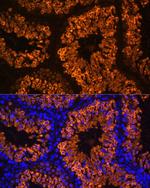 LDHC Polyclonal Antibody