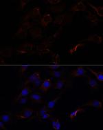 Septin-8 Antibody in Immunocytochemistry (ICC/IF)