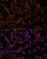 Septin-8 Antibody in Immunocytochemistry (ICC/IF)