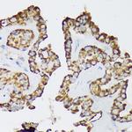 Septin-8 Antibody in Immunohistochemistry (Paraffin) (IHC (P))