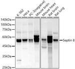 Septin-8 Antibody in Western Blot (WB)