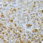 CTRB1 Polyclonal Antibody