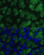 CTRB1 Antibody in Immunohistochemistry (Paraffin) (IHC (P))