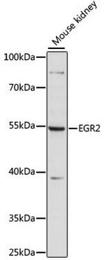 EGR2 Polyclonal Antibody