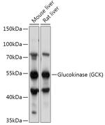 GCK Polyclonal Antibody