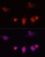 NPY Antibody in Immunocytochemistry (ICC/IF)