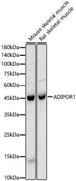 Adiponectin Receptor 1 Polyclonal Antibody